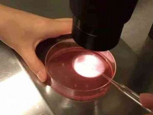 怀孕47天没有胎心胎芽正常吗？怀孕40天有胎心胎芽吗？