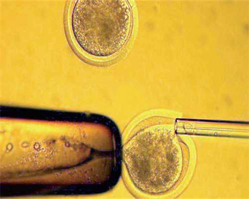 全国比较出名的借卵代生多少钱医院如何选择,做借卵代生多少钱的体验