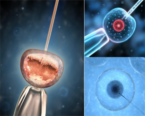 广西做三代代生机构靠谱吗价格大概是多少钱？