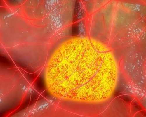 试管移植后能侧躺吗，子宫前位移植后怎么躺好着床？