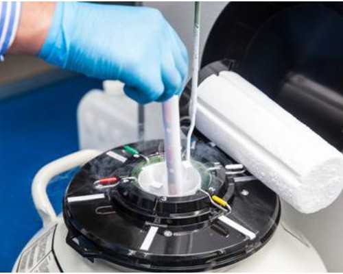 我想找个代孕,3分钟掌握多囊卵巢试管方案，情况不同选择还真不一样！