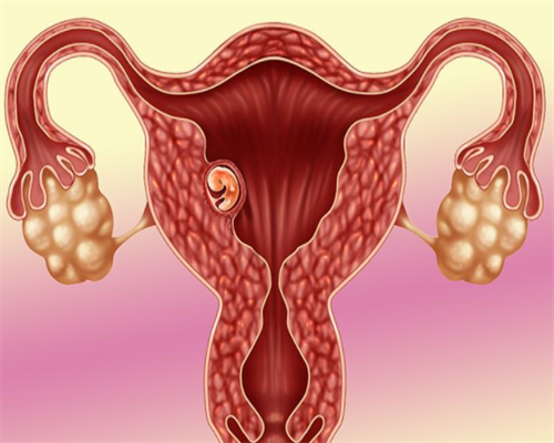 促排打完五针尿促后有褐色分泌物什么原因？是排卵了吗？