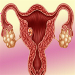 A套餐-促排打完五针尿促后有褐色分泌物什么原因？是排卵了吗？