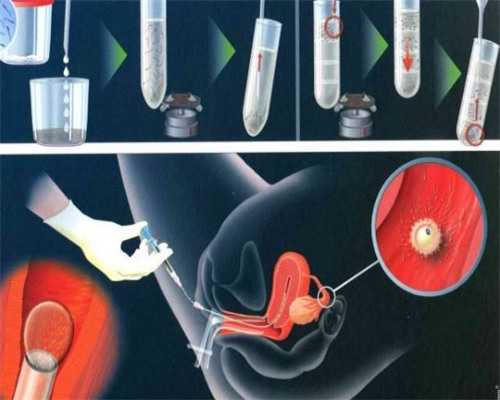 浙江3代试管医院排名最新名单！浙江大学医学院妇产科附属医院三代试管！