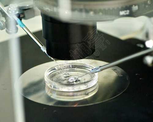 济南山大生殖医院做供精供卵代生电话价格多少钱?