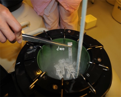 产后b超可以吃饭吗-产后b超查刀口怎么憋尿